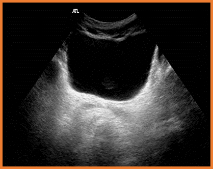 1 2 Transductores ATELPV Cursos